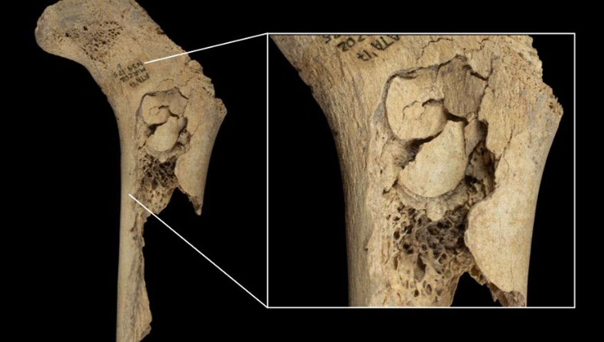 Neolithic Cannibals In Spain Ate Their Enemies As A Form “Ultimate Elimination”