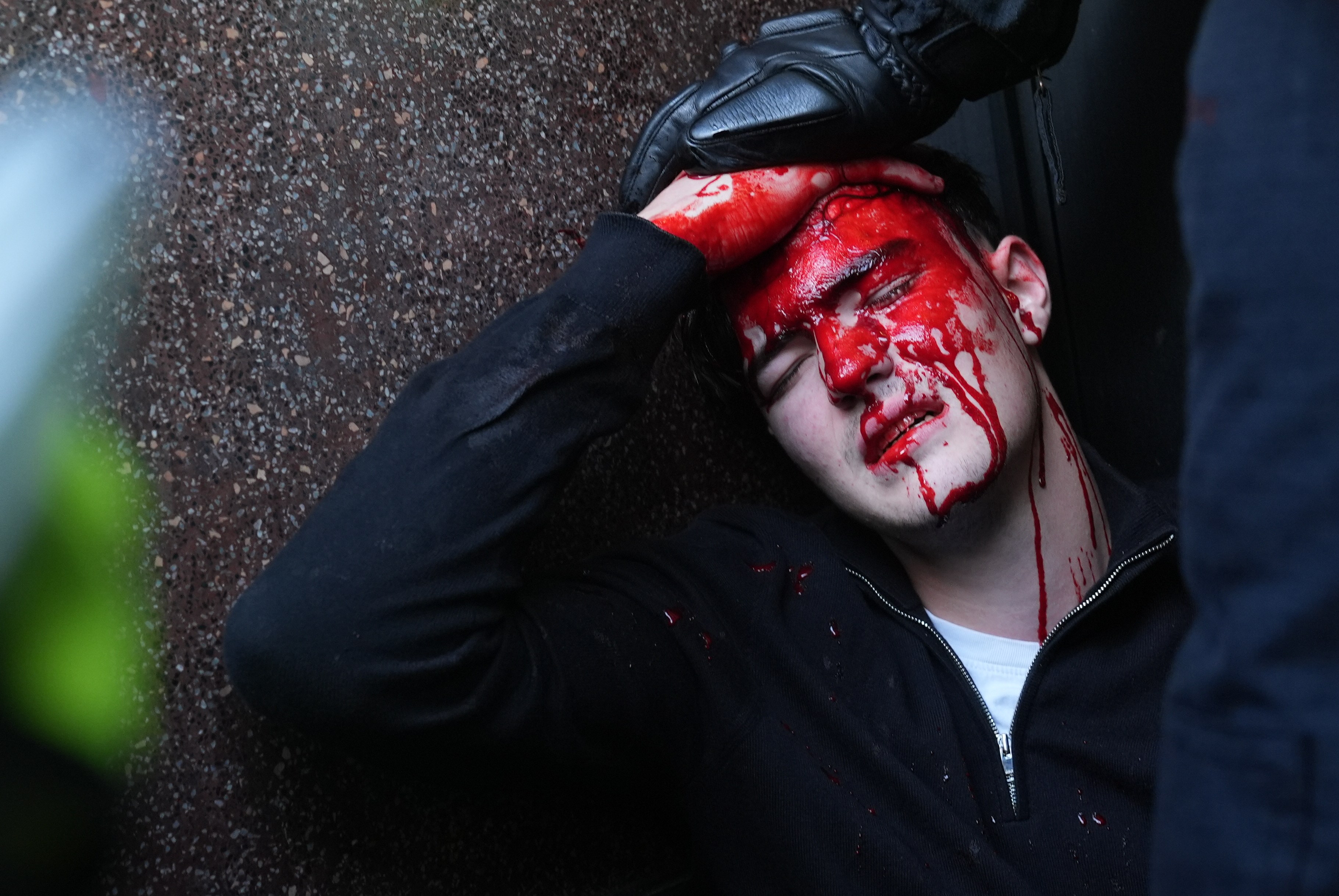 Person with head wound being treated by police.