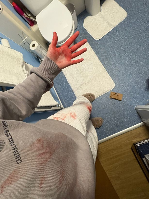 Pictured here is Naomi Evans covered in blood after helping two men who had been stabbed outside her home in the early hours of this morning