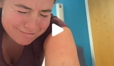 Lauren Bates (pictured) said she had six blood samples taken in one day as well as a nose swab 'rammed' up her nostrils every 12 hours