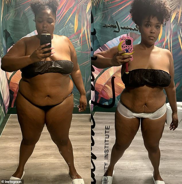 Lizzo credits her dramatic slim down to hard work and discipline, but has admitted she tried Ozempic and other GLP-1 drugs to help her on her journey