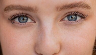 Musician David Bowie’s eyes appeared as different colours because of a permanently dilated pupil after an accident