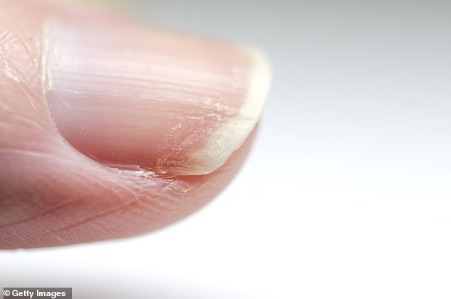 Blood circulation to the nail matrix, where the nail forms, decreases as we get older.