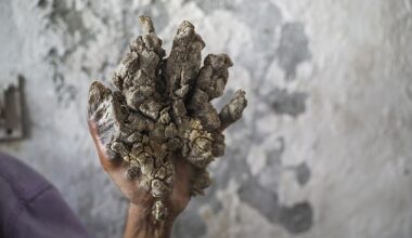 Dubbed tree man syndrome the people who have the skin disorder suffer from wart-like growths that resemble tree bark all over their bodies
