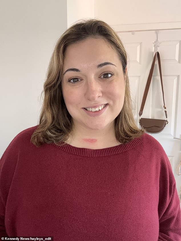 Hayley Black has been left with a scar on her neck from the life-saving operation
