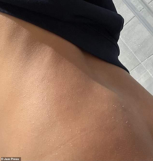 It wasn't until she discovered the lump pictured that she went on to find out the true cause of the pain she had been experiencing