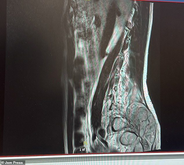 Ms Kalkan was going to the doctors multiple times a month with complaints of pain in her back