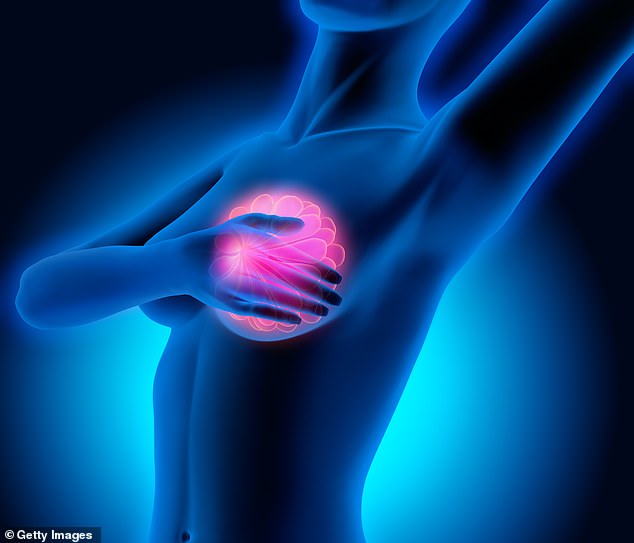 An estimated 40 per cent of women successfully treated for primary breast cancer retain traces of these inert ‘sleeper cells’ when they go into remission
