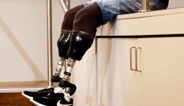 Kremlin official hails Ukraine war for helping ‘great leap’ in prosthetics – POLITICO