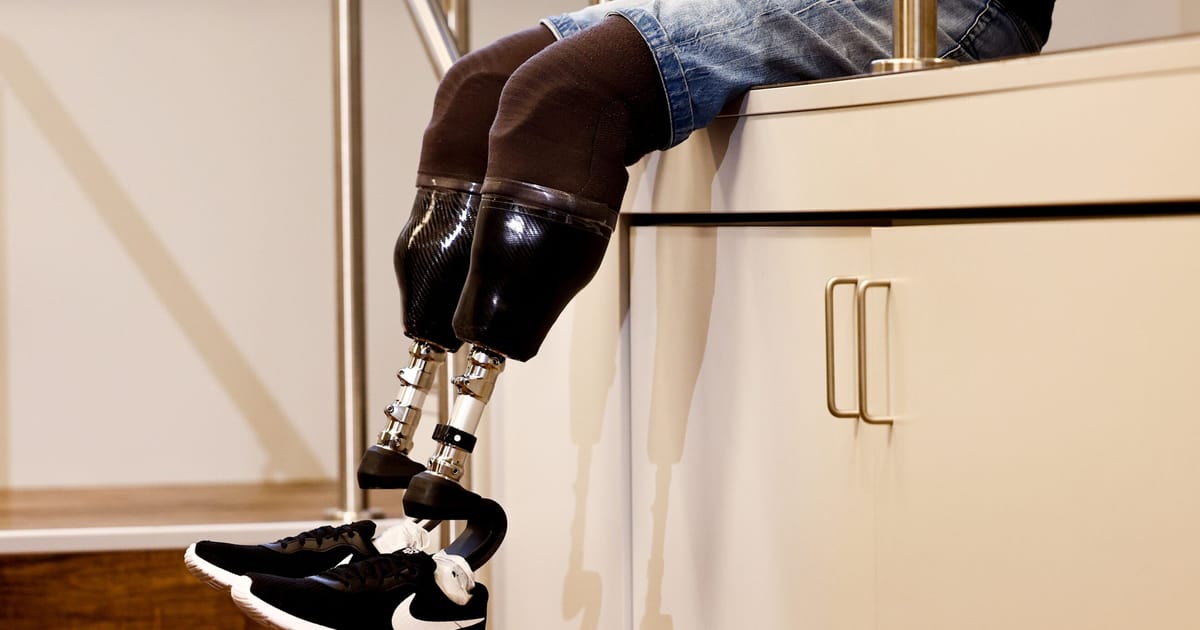 Kremlin official hails Ukraine war for helping ‘great leap’ in prosthetics – POLITICO