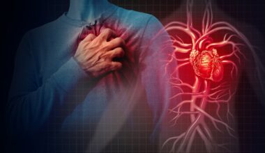Cardiologist says ‘exercise daily for at least 45 minutes'; shares tips to protect your heart during festivals | Health
