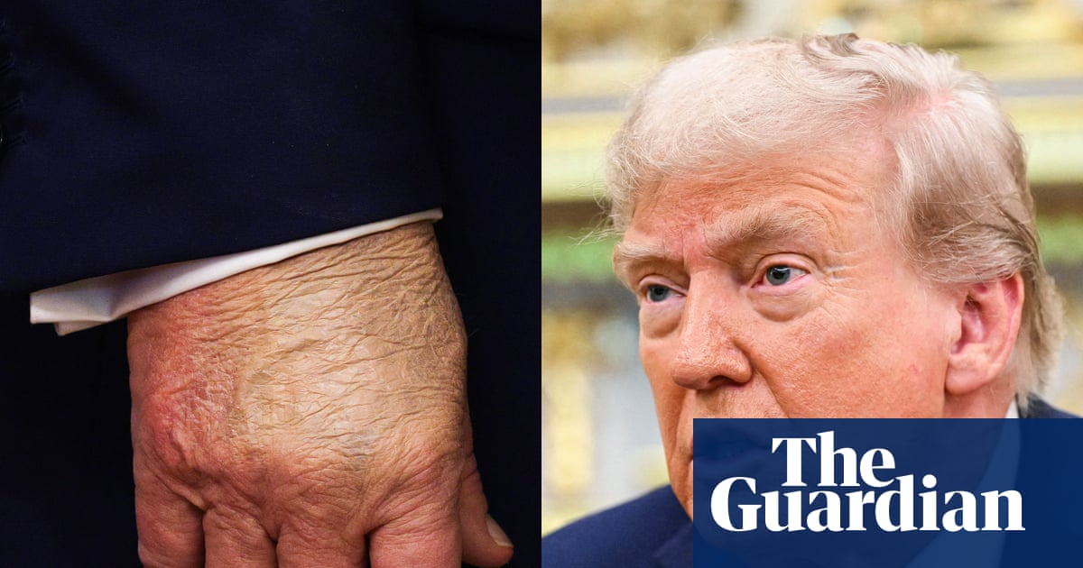 What the ‘is Trump dead?’ rumours reveal about our current moment | Donald Trump