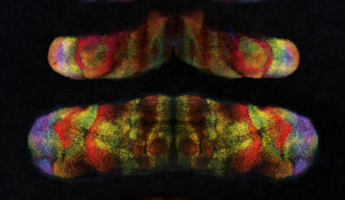 Genetic deletion in cerebellum impedes hemisphere formation, study finds