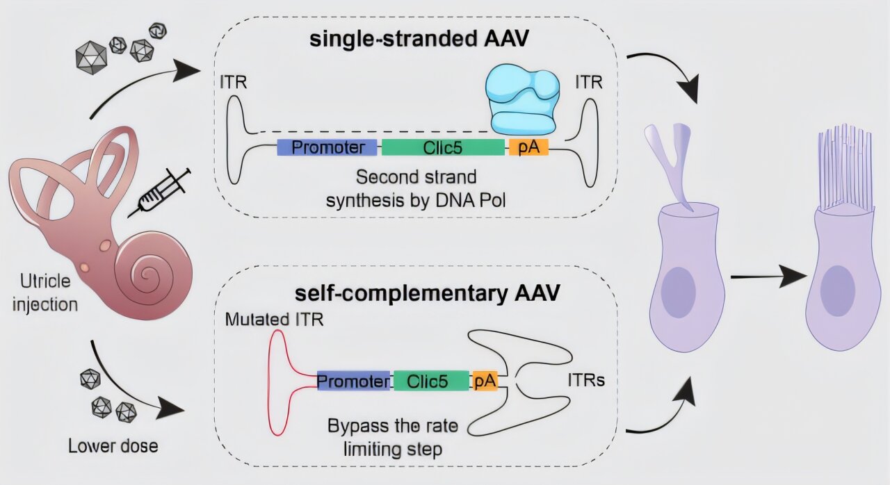 Gene therapy safeguards hearing, balance in preclinical test