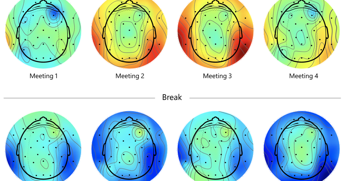 This Is What Happens To Your Brain When You're In Meetings All Day