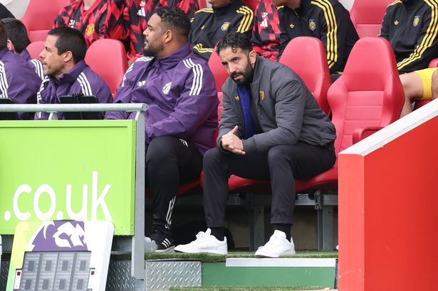 Man United boss Ruben Amorim looks on