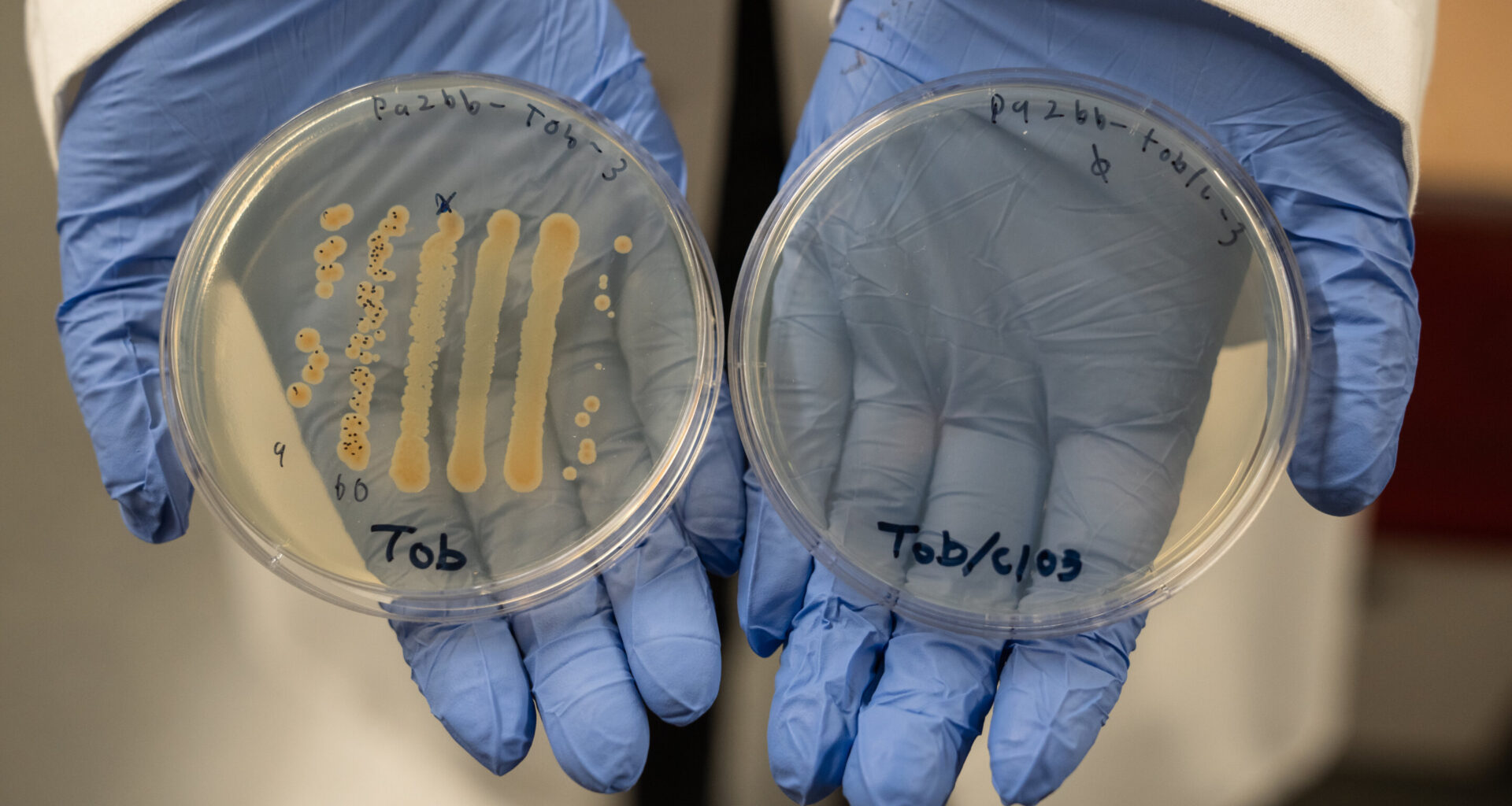 Two-drug combination shows promise in helping heal chronic wounds