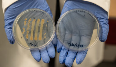 Two-drug combination shows promise in helping heal chronic wounds