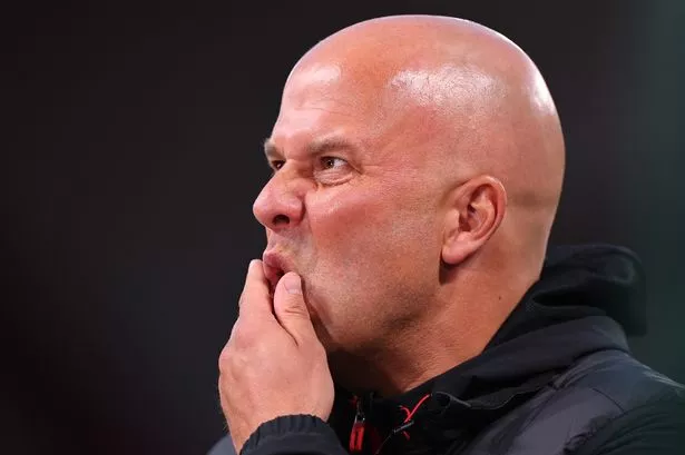 Liverpool head coach Arne Slot looks on while putting his hand to his face