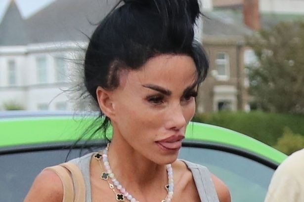 Katie Price pictured with cut on her eye