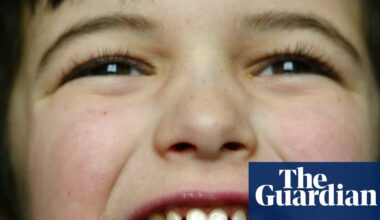 Tackle the sugar lobby to save young teeth | Health