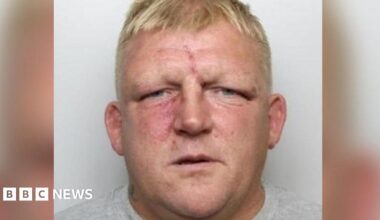 Glynn Leedell has short blonde hair and has a visible red scar on his forehead and what appears to be bruising beneath his right eye.