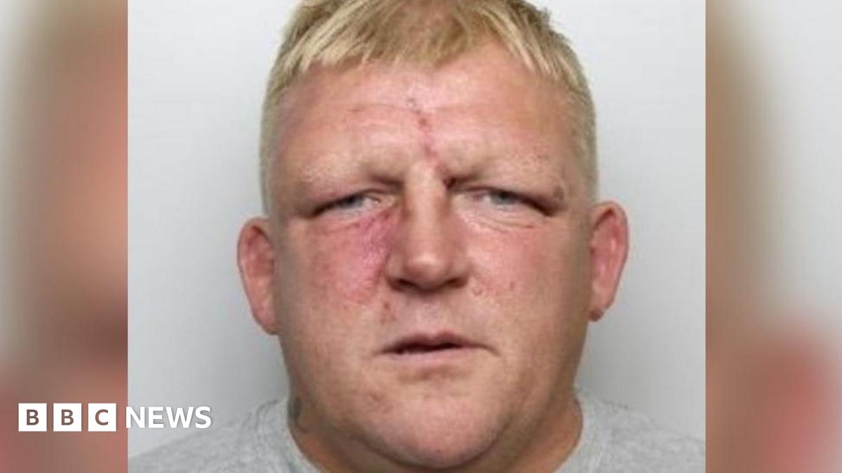 Glynn Leedell has short blonde hair and has a visible red scar on his forehead and what appears to be bruising beneath his right eye.