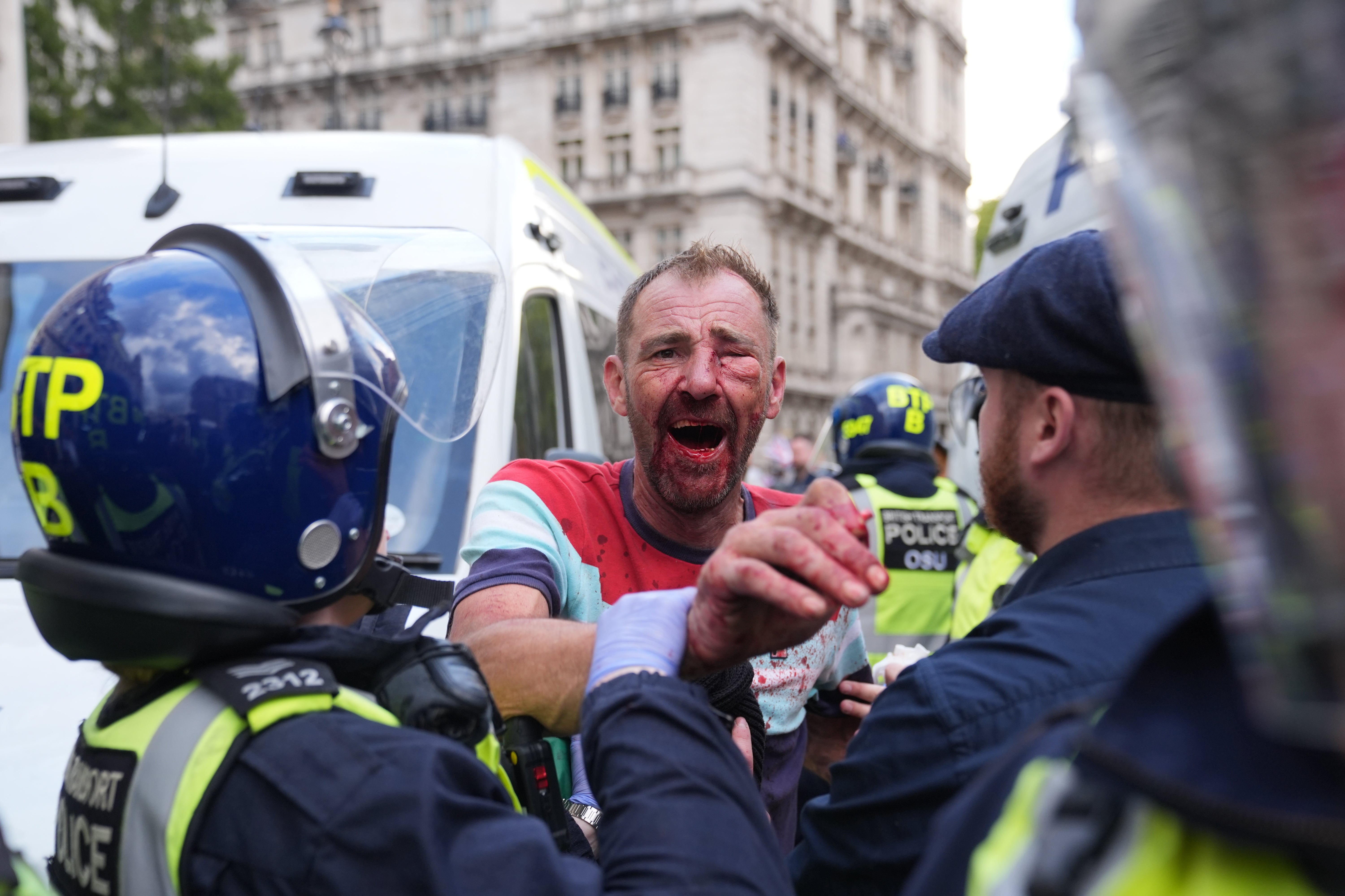 A person with a bloodied face and clothing confronting police officers