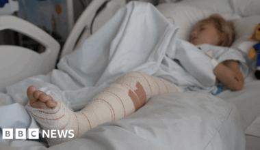 E-bike injuries are a massive burden, say Royal London Hospital surgeons