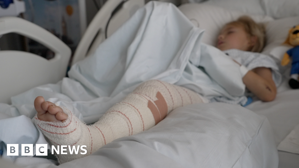 E-bike injuries are a massive burden, say Royal London Hospital surgeons