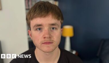 'Losing my hair at 16 has controlled me'
