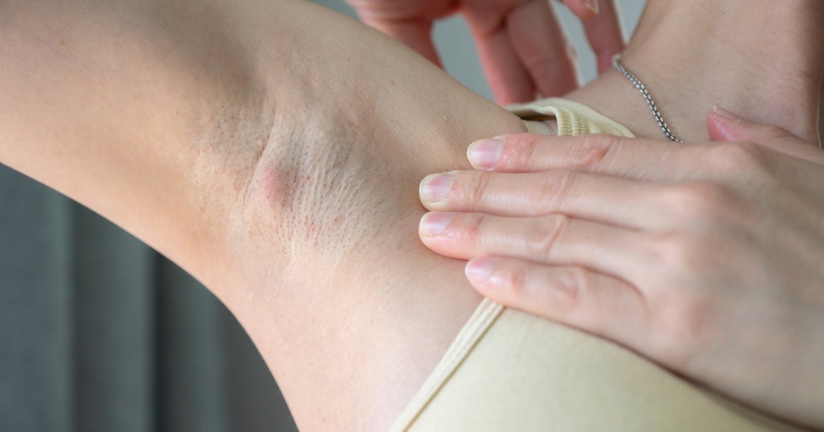 6 Symptoms A Lymphoma Doctor Would Never Ignore