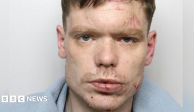 A police image of a man with cuts to his face and a blue blanket around his shoulders.