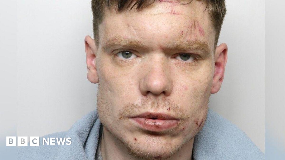 A police image of a man with cuts to his face and a blue blanket around his shoulders.