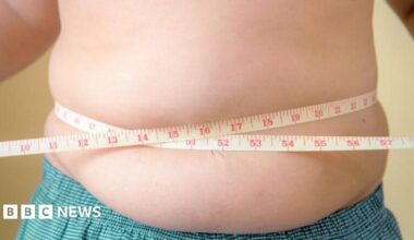 An overweight young boy holds a tape measure around his waist