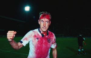 Terry Butcher was soaked in blood yet still played for England