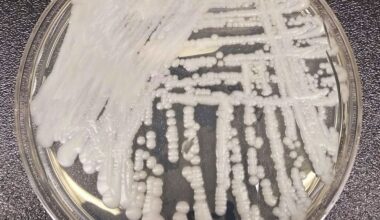 Drug-resistant fungus spreads through hospitals