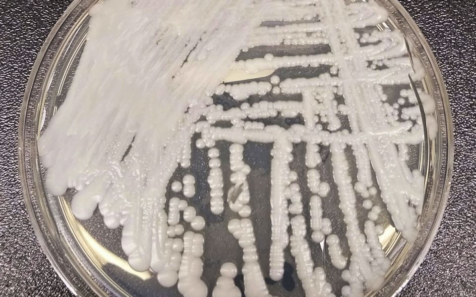 Drug-resistant fungus spreads through hospitals