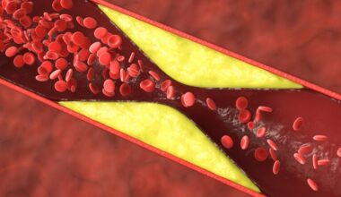 Half of Heart Attacks in Younger Women Aren't From Clogged Arteries : ScienceAlert