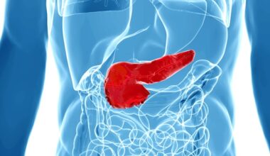 New genetic test redefines diagnosis and management of hereditary pancreatitis