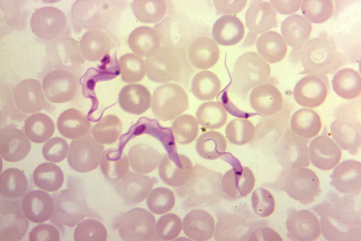 Californians warned of invisible disease that can cause heart attacks and strokes - The Independent