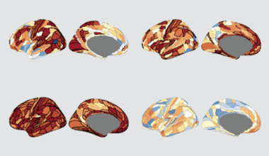 Autism-linked copy number variants always boost autism likelihood