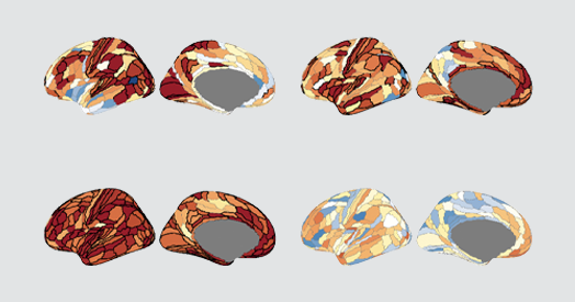 Autism-linked copy number variants always boost autism likelihood