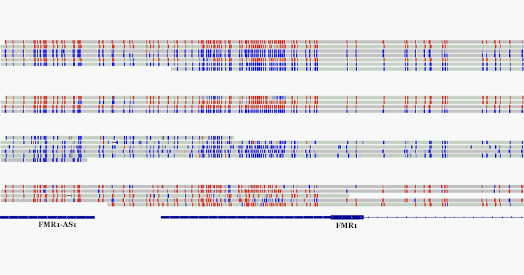 Long-read sequencing unearths overlooked autism-linked variants
