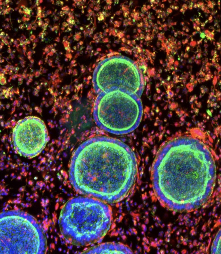 Micrograph showing large green and blue cells against a background of smaller red ones.