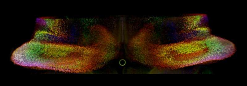 Genetic deletion in the cerebellum impedes hemisphere formation