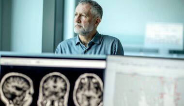 Why this common gene variant is bad for your brain