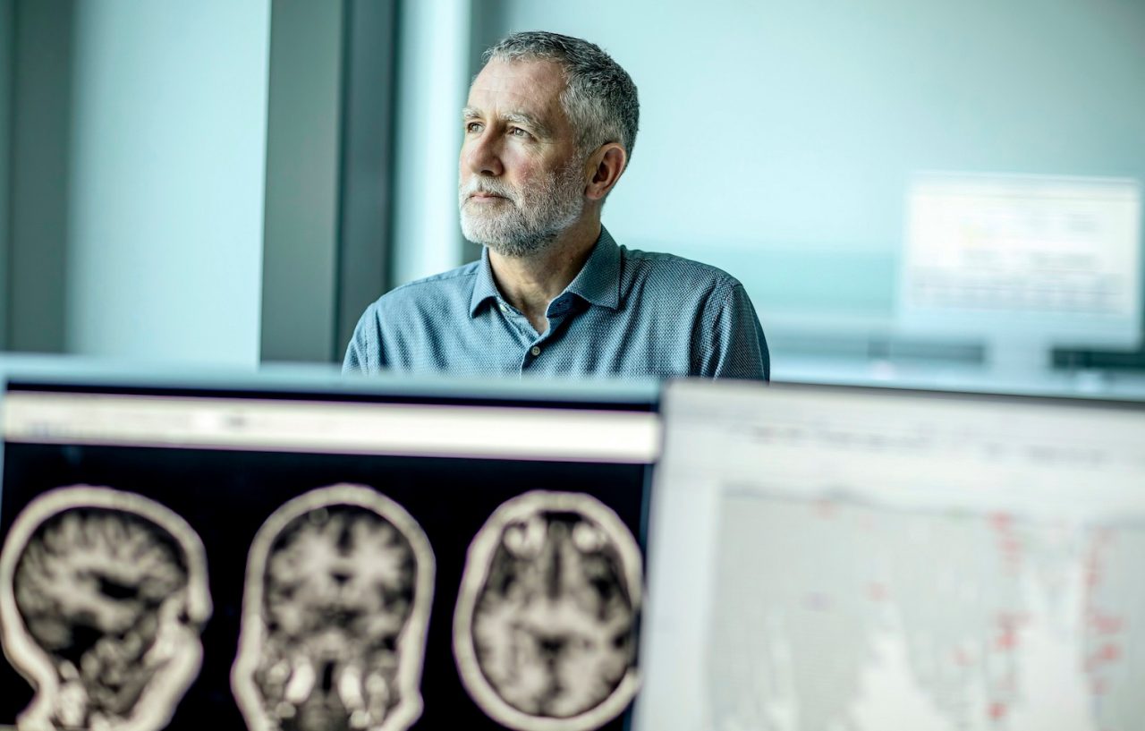 Why this common gene variant is bad for your brain