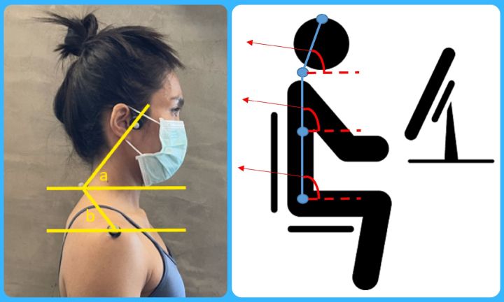 Depiction of bad posture.