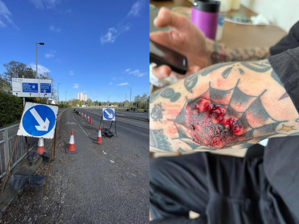 Council settles with cyclist injured in cycle lane crash